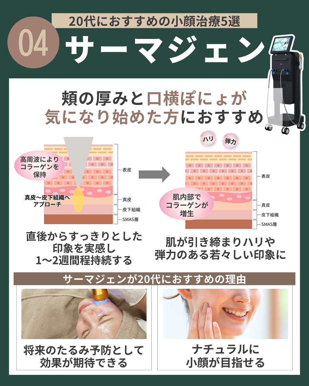 (4)サーマジェン
