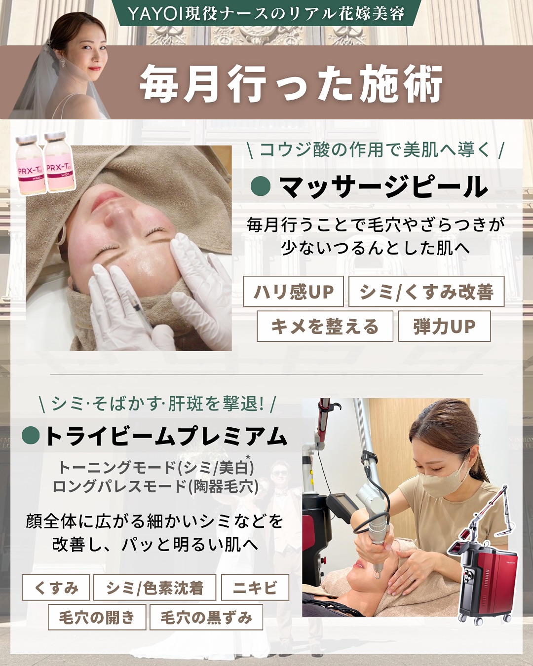 Monthly Beauty Treatments for Brides