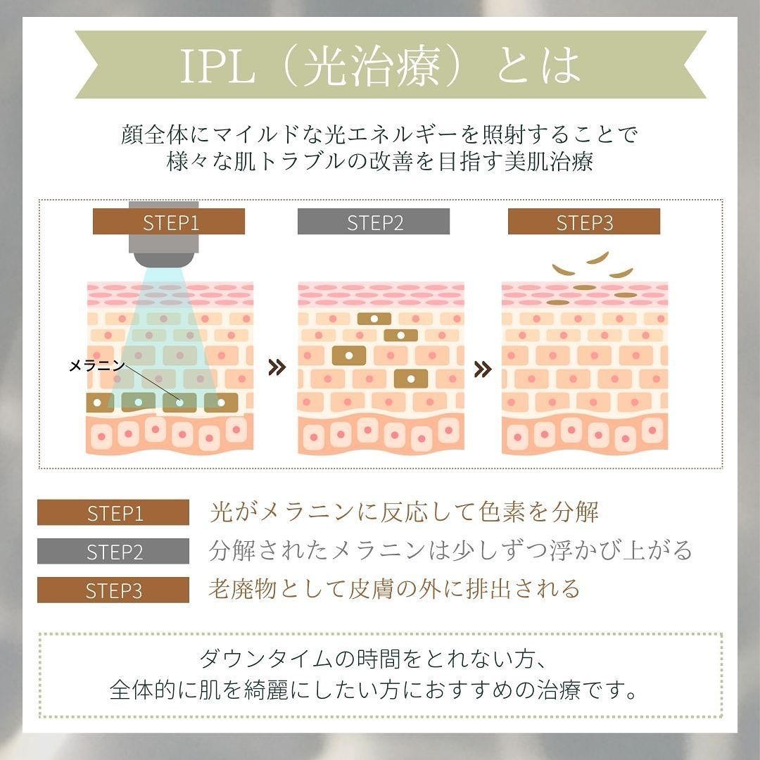 IPL（光治療）とは