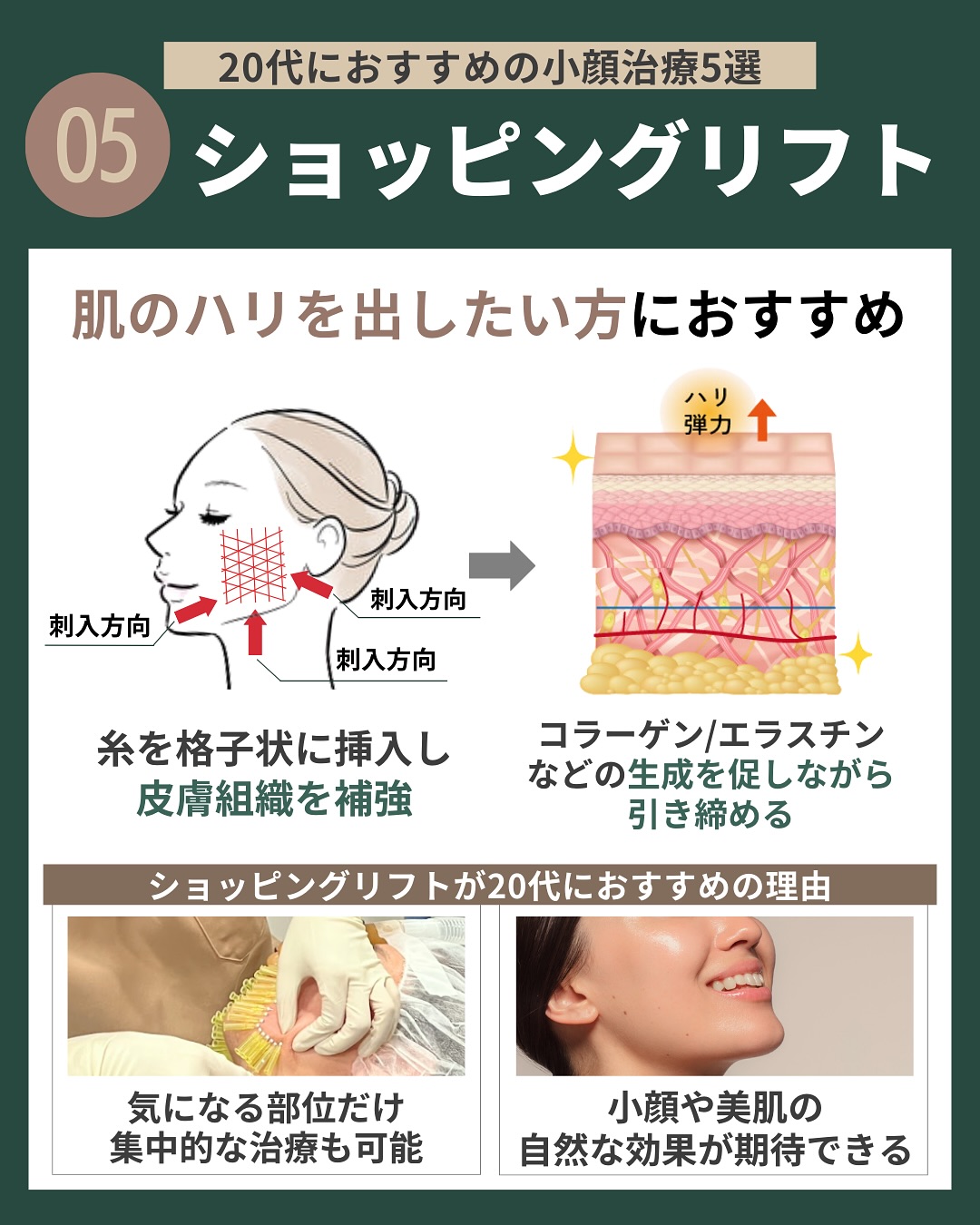 (5)ショッピングリフト