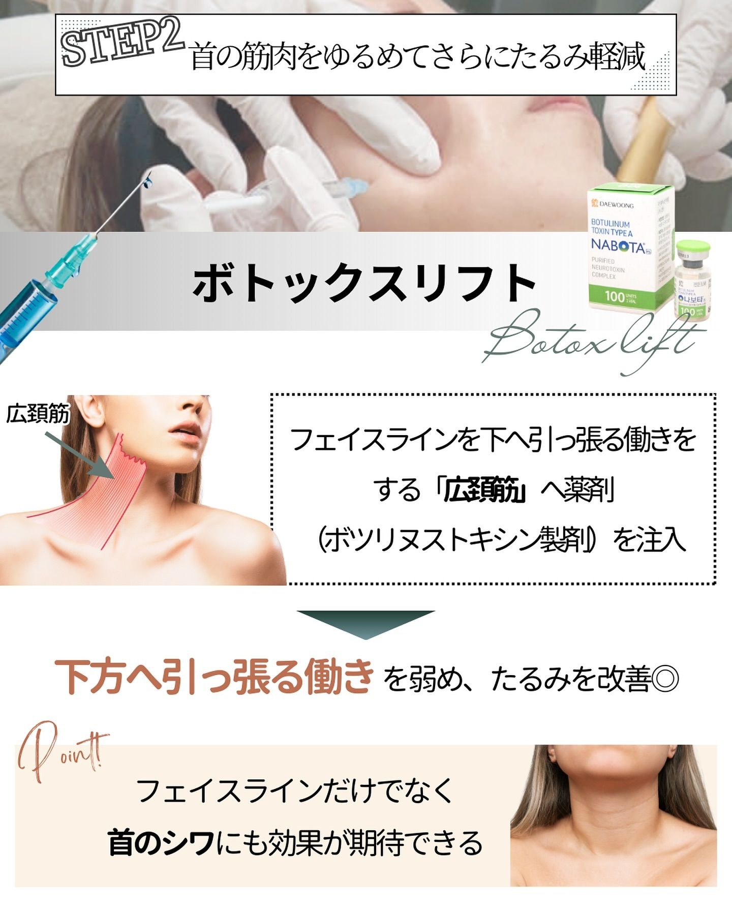 Botox lift