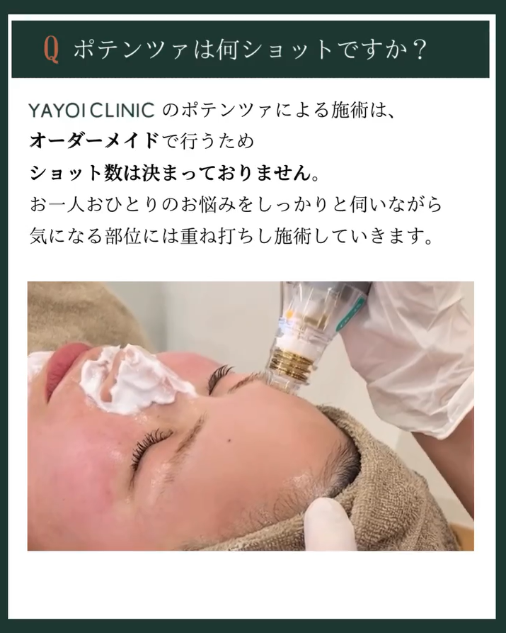 Q＆Aその1