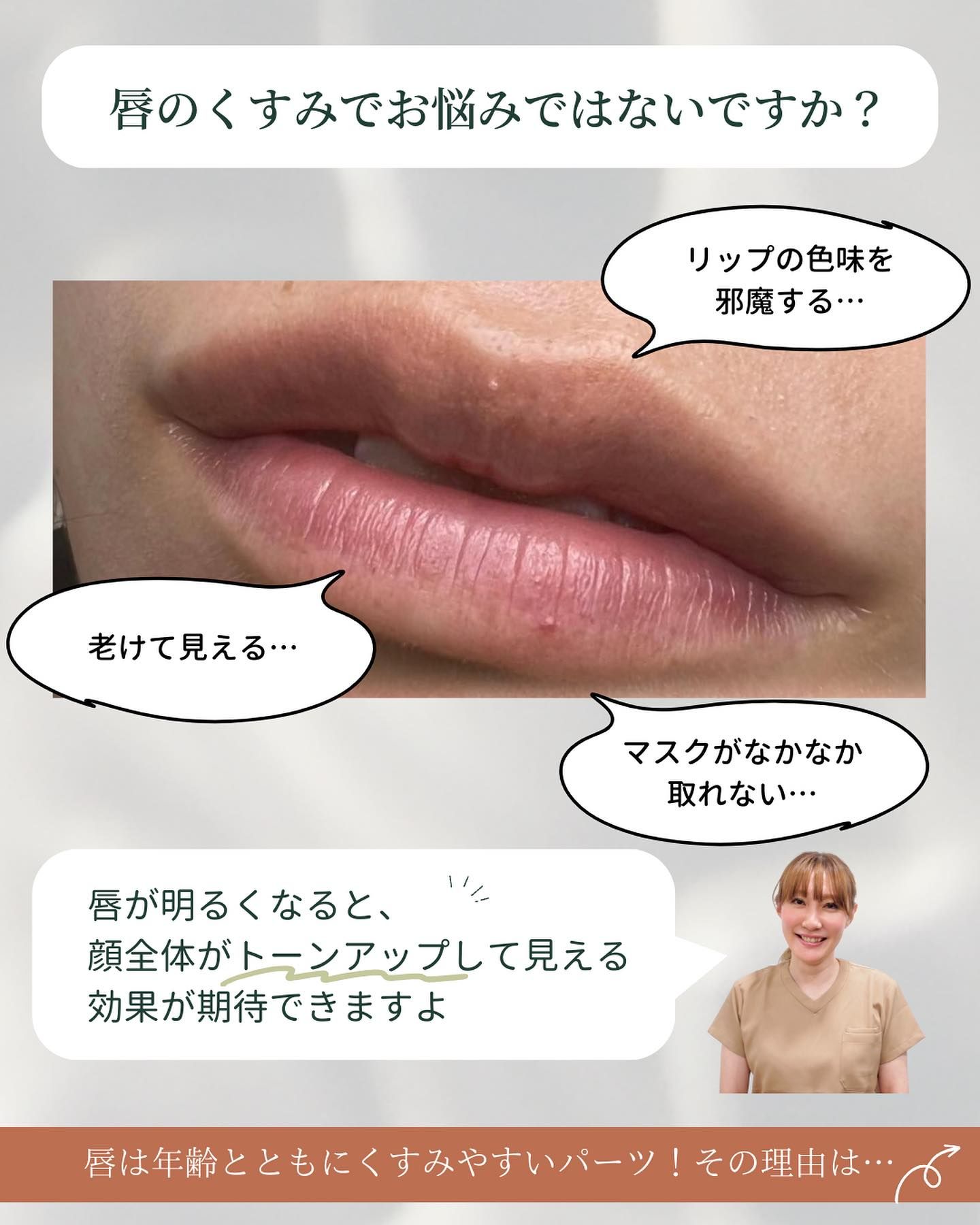 Are you worried about dull-looking lips?