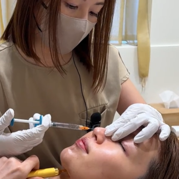 Hyaluronic Acid Injections for the Nose
