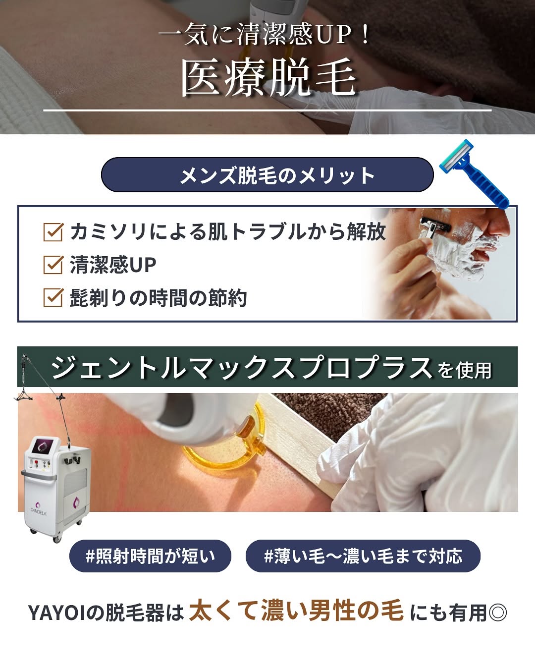 メンズ　医療脱毛
