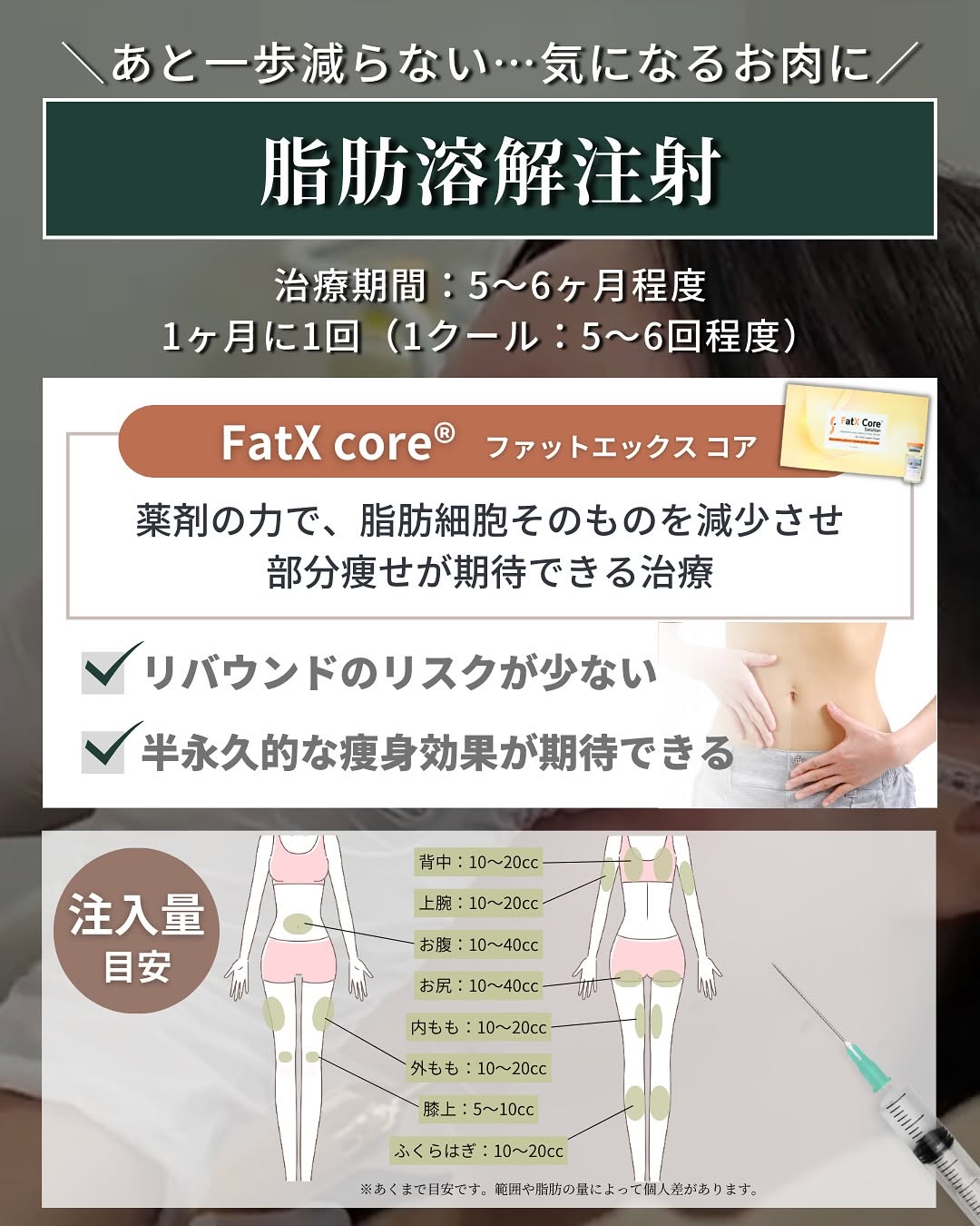 Fat-dissolving Injections (Lipolysis)