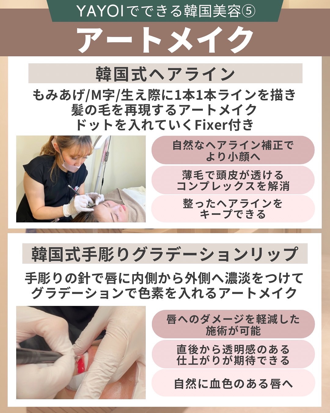 アートメイク　小顔