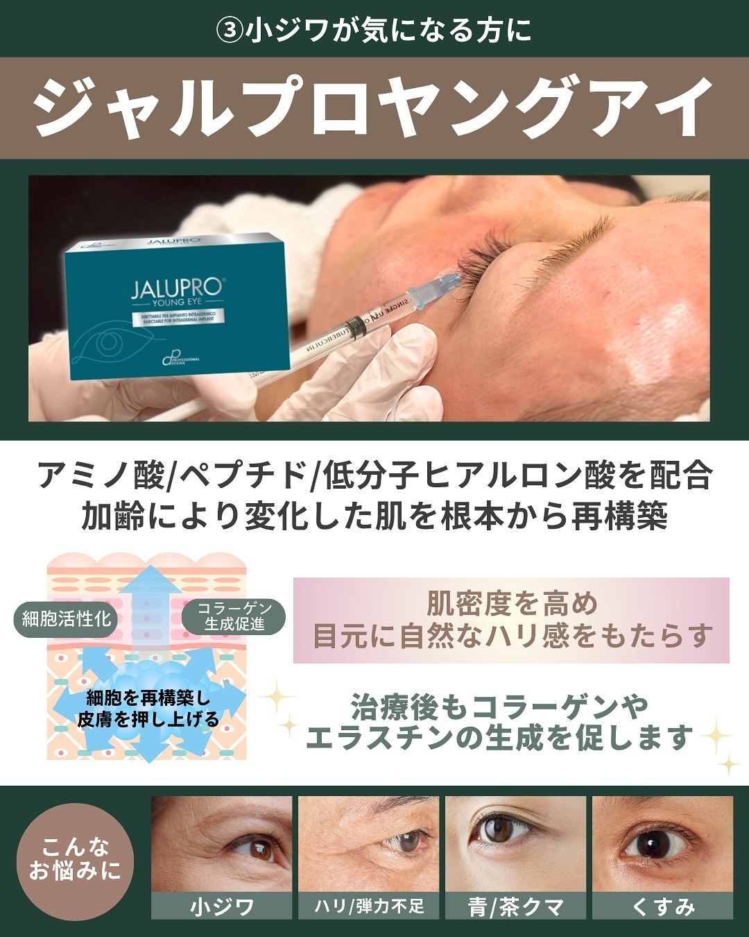Jalupro Young Eye