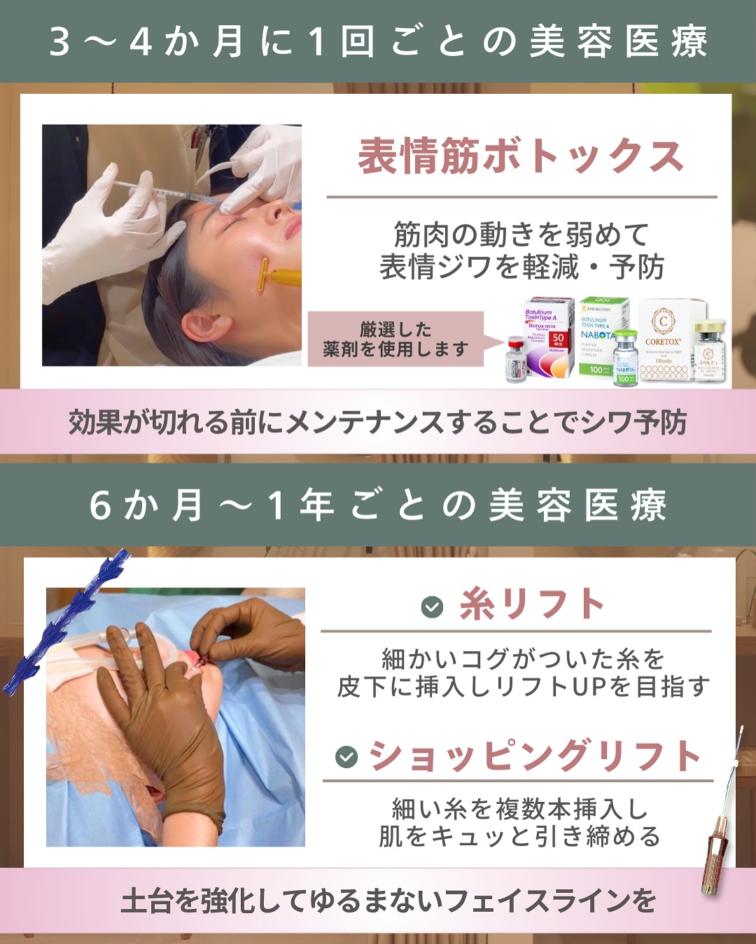 3～4ヶ月・1年以内施術の美容医療3選