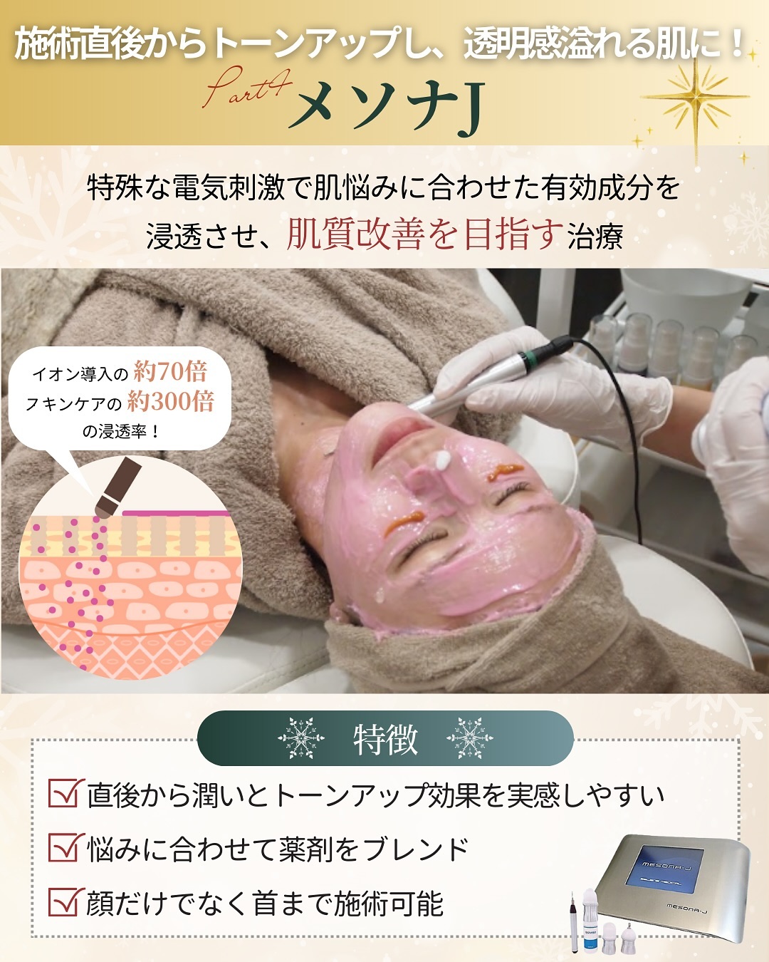 メソナＪの特徴