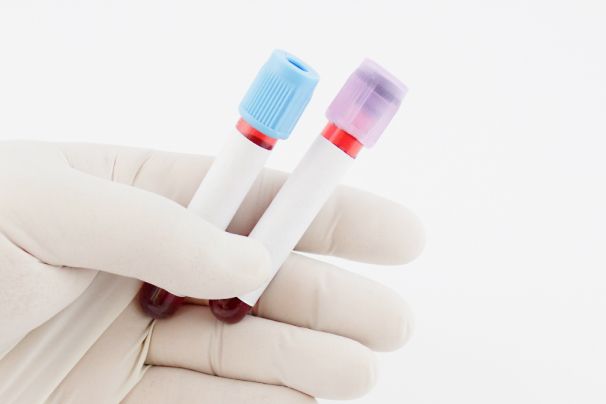 Get Tested for Nutrients You’re Lacking! Hiroshima’s Yayoi Clinic Explains Why It’s Important