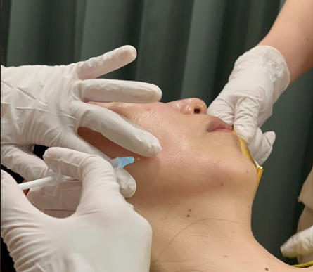 Jaw Botox in Hiroshima | Tips Before and After Treatment, Plus Clinics That Treat Men
