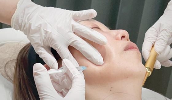 Get Botox at a cosmetic dermatology clinic in Naka Ward, Hiroshima City! An easy-to-understand explanation of the treatment’s features